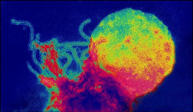 Virus spalniček